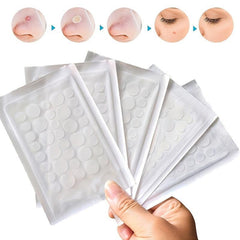Hydrocolloid Acne Pimple Patches - Cover Pimples & Blemishes