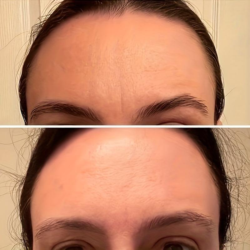 Facial Patches For Wrinkles - 144 Patches