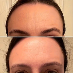 Facial Patches For Wrinkles - 144 Patches