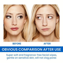 Gentle Makeup Remover Wipes Deep Cleansing Face Eye Lip Makeup 10pcs