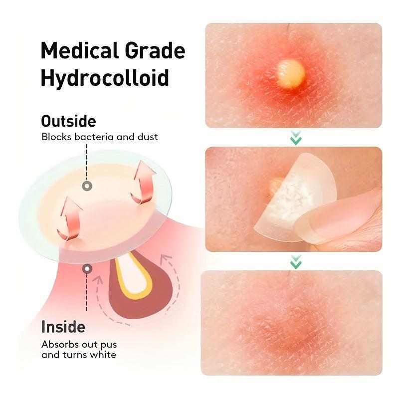 Acne Pimple Patch for Zits Blemishes Spot Stickers Face Skin