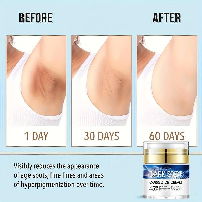 Dark Spot Fade Cream - Hydrating Formula for Even Skin Tone 50g