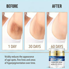 Dark Spot Fade Cream - Hydrating Formula for Even Skin Tone 50g