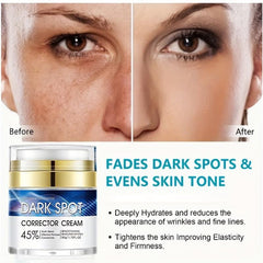 Dark Spot Fade Cream - Hydrating Formula for Even Skin Tone 50g