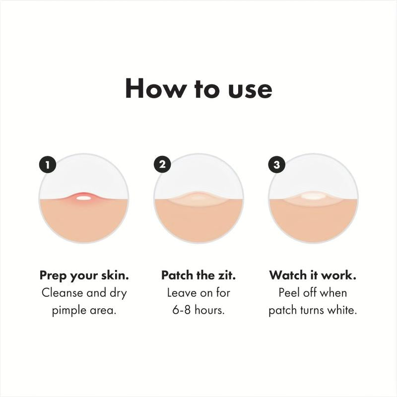 Hydrocolloid Acne Patches - Cover Zits and Blemishes