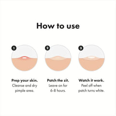 Hydrocolloid Acne Patches - Cover Zits and Blemishes