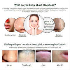 Blackhead Cover Nose Mask - Shrink Pores & Tighten Skin