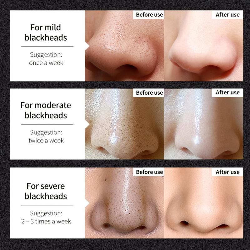 Blackhead Cover Nose Mask - Shrink Pores & Tighten Skin