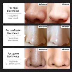 Blackhead Cover Nose Mask - Shrink Pores & Tighten Skin