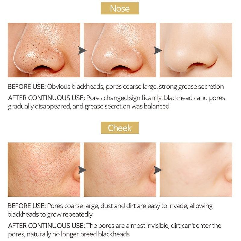 Blackhead Cover Nose Mask - Shrink Pores & Tighten Skin