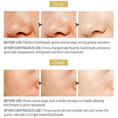 Blackhead Cover Nose Mask - Shrink Pores & Tighten Skin