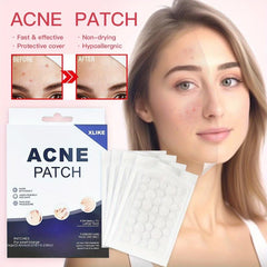 360pcs Hydrogel Acne Patch Label Cover Patch