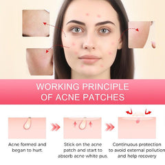 360pcs Hydrogel Acne Patch Label Cover Patch