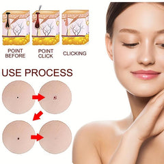 Hydrocolloid Acne Pimple Patch for Clear Skin