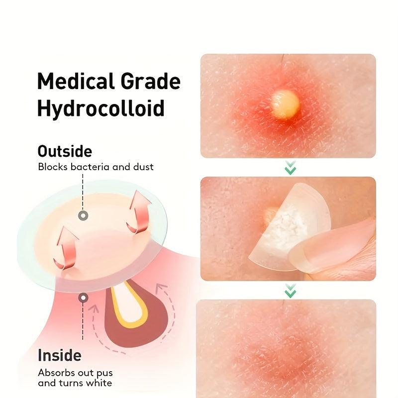 Hydrocolloid Acne Pimple Patch for Clear Skin