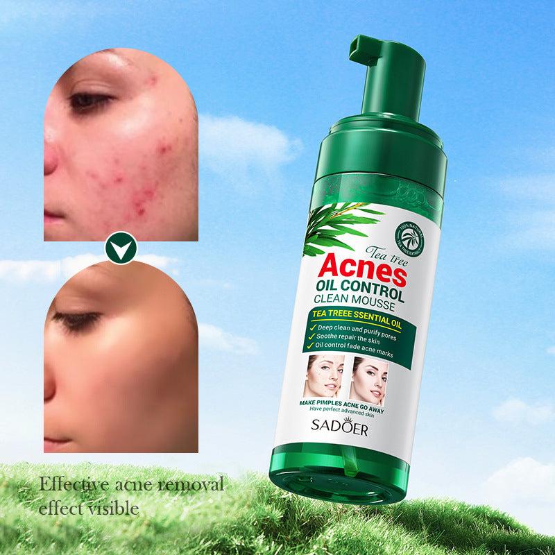 Tea Tree Mousse Facial Cleanser 150g