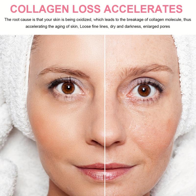 Collagen Cream Hyaluronic Acid Lotion Restores Sagging Skin