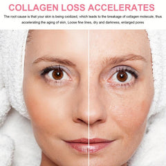 Collagen Cream Hyaluronic Acid Lotion Restores Sagging Skin