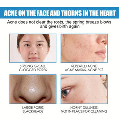 B5 Moisturizing Nourishing Cream for Skin Tone Relief