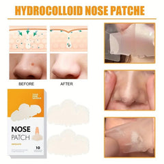 Hydrocolloid Pimple Patches Acne Nose Pore Strips 10 Count