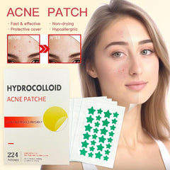 Star-Shaped Acne Patches, Hydrocolloid Absorbing, Colorful