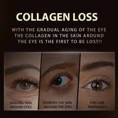 40g Collagen Eye Cream: Fade Fine Lines, Dark Circles & Eye Bags