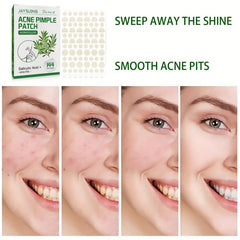 Tea Tree Acne Pimple Patches Hydrocolloid Waterproof Spot Stickers
