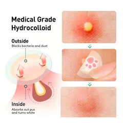 Hydrocolloid Acne Pimple Patch Tea Tree Facial Sticker