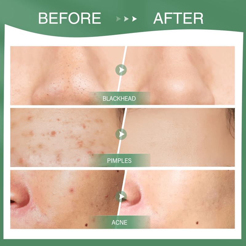Green Tea Mud Stick Mask for Blackheads and Pore Purifying