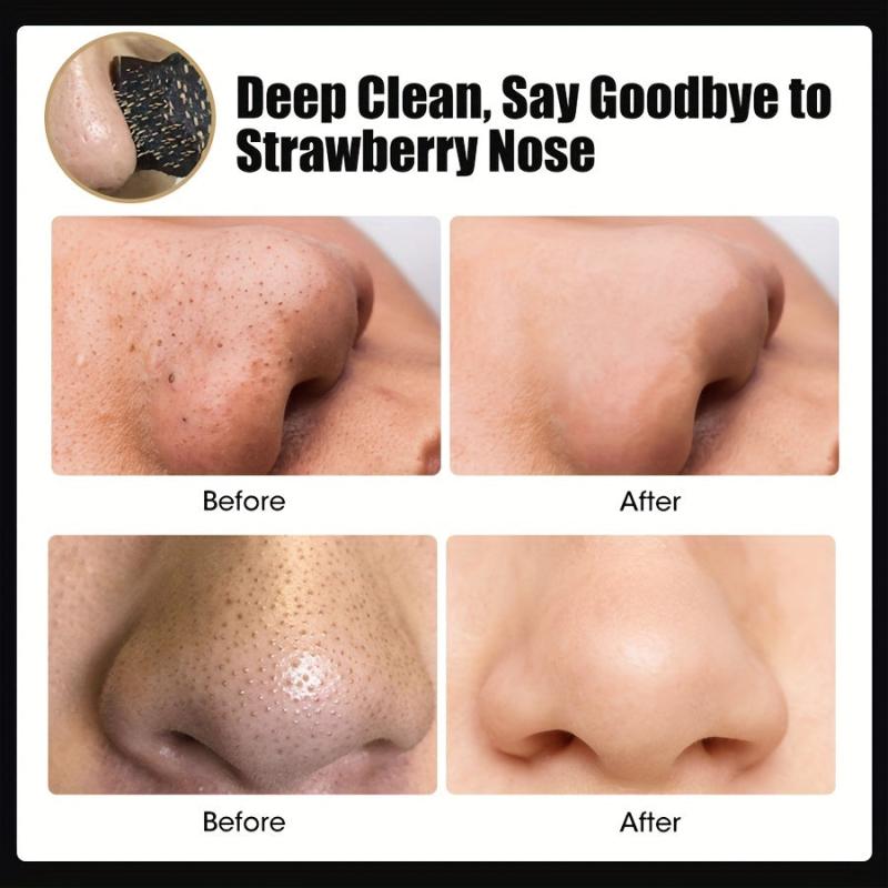 10pcs Mango Blackhead Cleansing Nasal Masks - Deep Cleansing Pimples