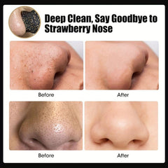 10pcs Mango Blackhead Cleansing Nasal Masks - Deep Cleansing Pimples