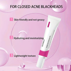 Salicylic Acid Pore Cleansing Cream for Acne and Blackheads
