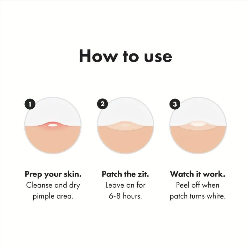 Acne Pimple Patch Hydrocolloid Spot Stickers for Face Skin