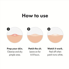 Acne Pimple Patch Hydrocolloid Spot Stickers for Face Skin