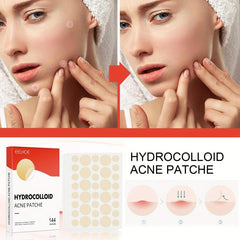 Vegan Acne Pimple Patches - Spot Stickers for Face