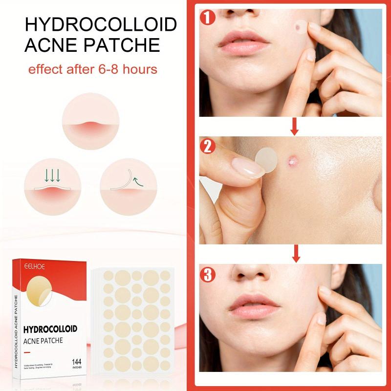 Vegan Acne Pimple Patches - Spot Stickers for Face