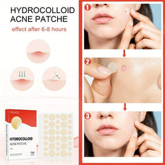 Vegan Acne Pimple Patches - Spot Stickers for Face