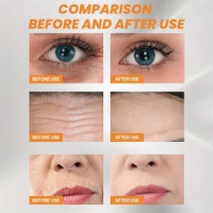 V Shape Face Lift Patch Double Chin Face Sticker
