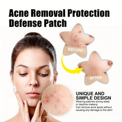 60pcs Colorful Acne Removal Patchs Invisiable Acne Covering Patch