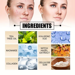 60pcs Colorful Acne Removal Patchs Invisiable Acne Covering Patch
