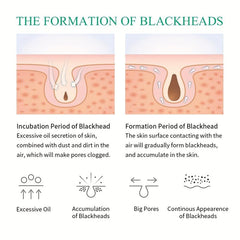 10 Pcs Hydrocolloid Nose Patches Blackhead Remover Strips