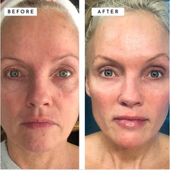Hydrating Retinol Cream with Hyaluronic Acid for Face