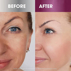 Hydrating Retinol Cream with Hyaluronic Acid for Face