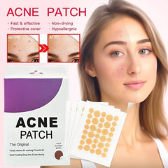 Hydrocolloid Acne Patches 360pcs, Daily Skin Care for Pimples and Blemishes