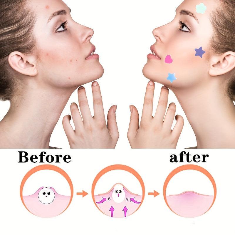 Colorful Hydrocolloid Acne Patch Acne Stickers For Women's Face Skin