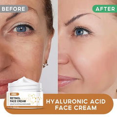 Retinol Face Moisturizer with Hyaluronic Acid