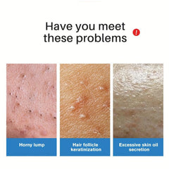 Coconut Scrub Soap Removes Dead Skin Tightens Hair