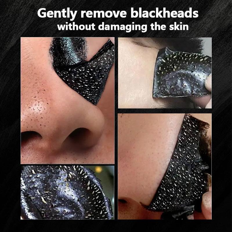 2pcs Activated Charcoal Blackhead Remover Mask 60g