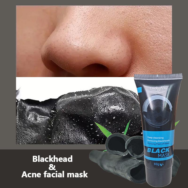 2pcs Activated Charcoal Blackhead Remover Mask 60g