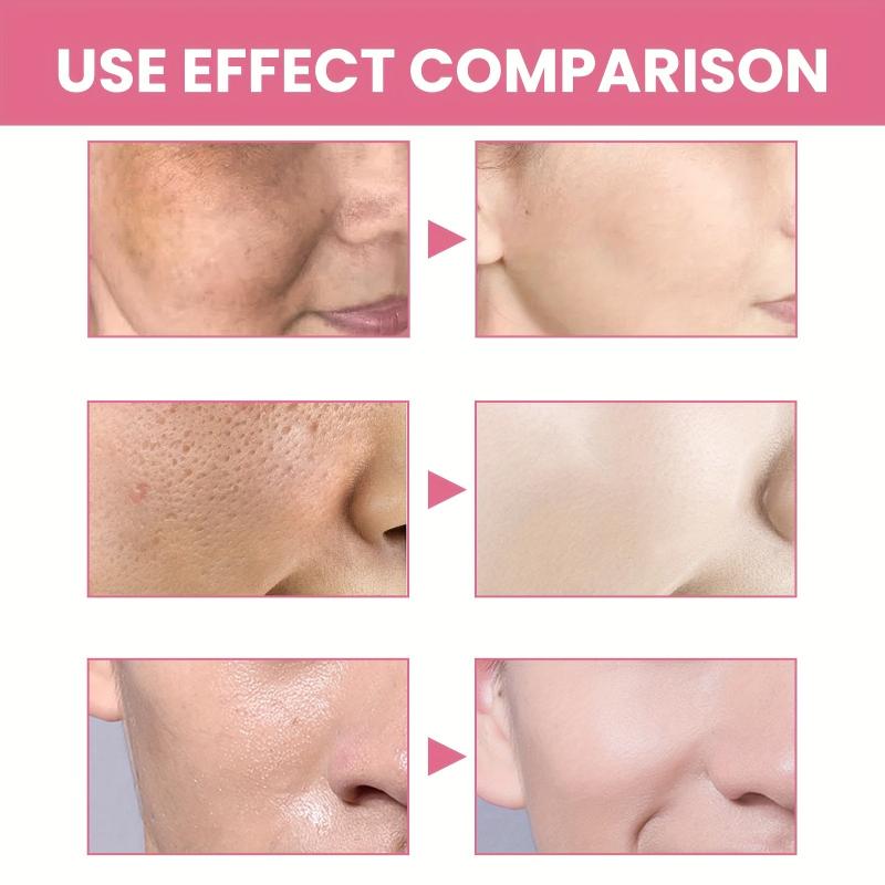 Facial Enzyme Cleansing Powder - Spots Acne Pores - 5pcs